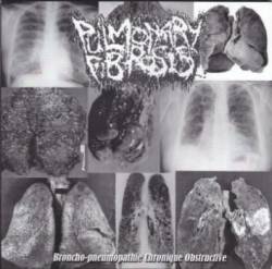 Pulmonary Fibrosis : Broncho-pneumopathie Chronique Obstructive - Suppository of Speed